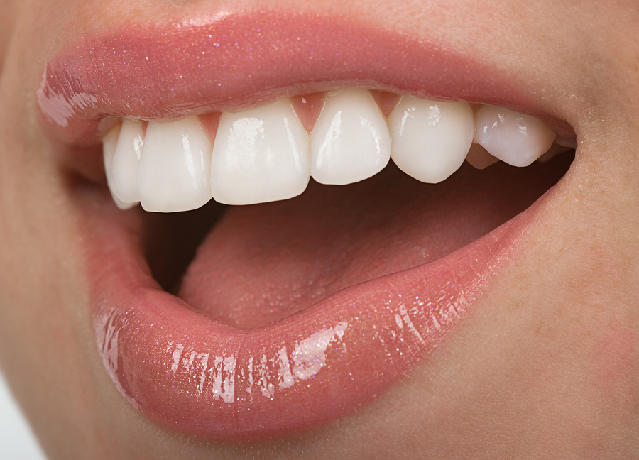 teeth whitening in worcester, MA